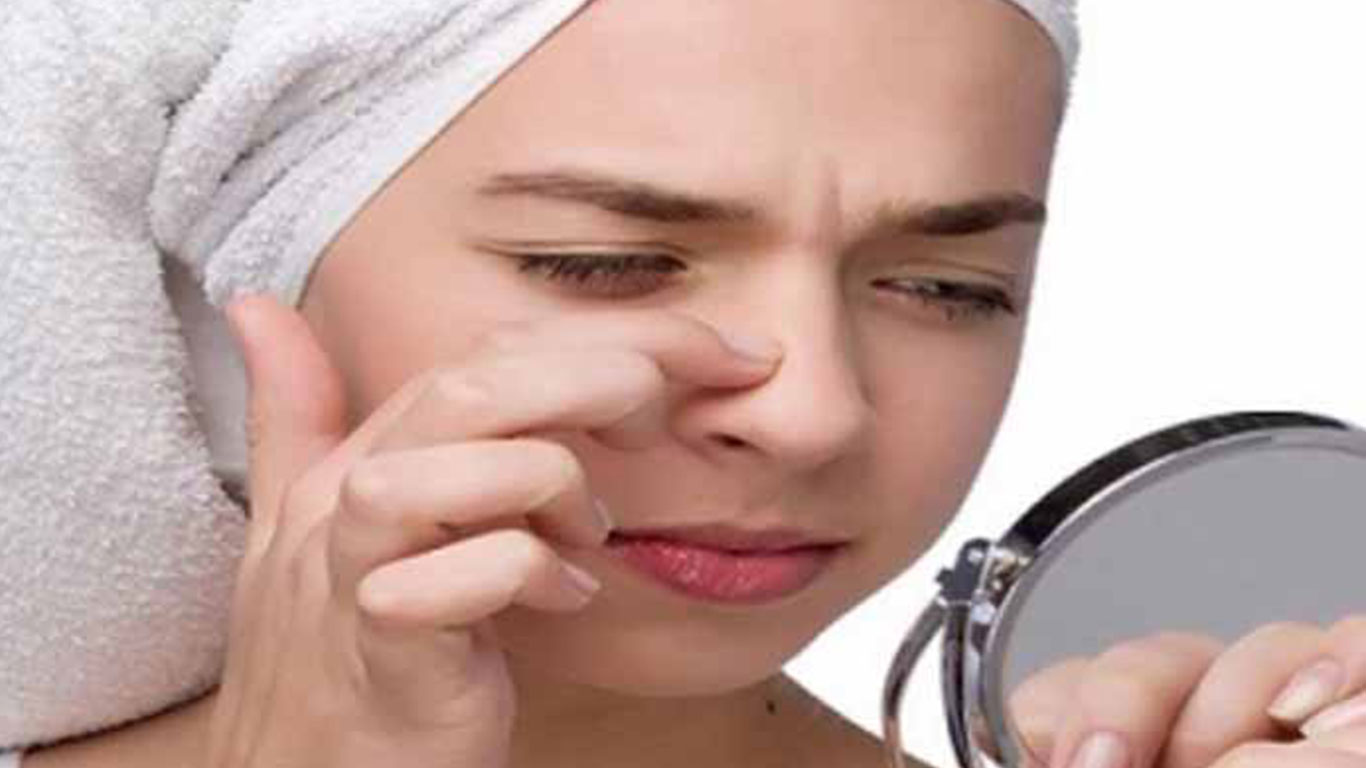 ব্ল্যাকহেডস দূর করার উপায়