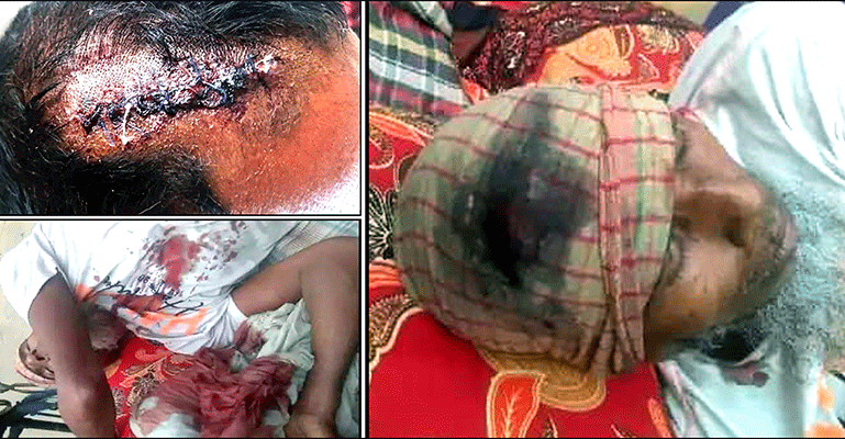 মোড়েলগঞ্জে জমি বিরোধে স্বামী-স্ত্রীকে কুপিয়ে জখম