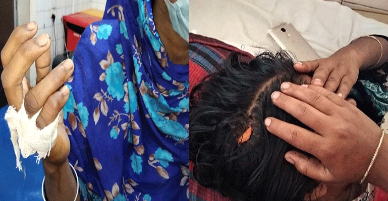 জয়পুরহাটের পল্লীতে ৩ গৃহবধূকে বেদম প্রহারের অভিযোগ