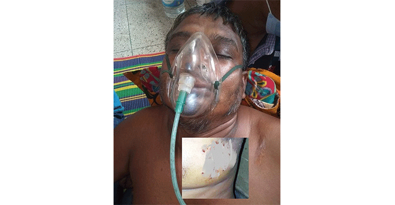 মোড়েলগঞ্জে পারিবারিক শত্রুতার জেরে হামলা, তাঁতীলীগ নেতাসহ আহত ৩