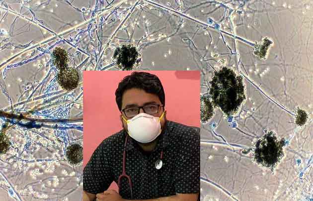 কালো ছত্রাক বা ব্ল্যাক ফাংগাস নিয়ে খুব মাতামাতি!