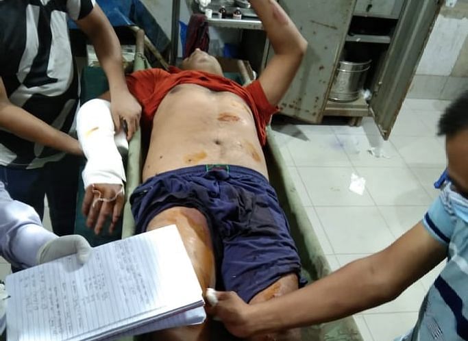 বসুরহাটে মির্জা কাদেরের ৬ অনুসারী গুলিবিদ্ধ