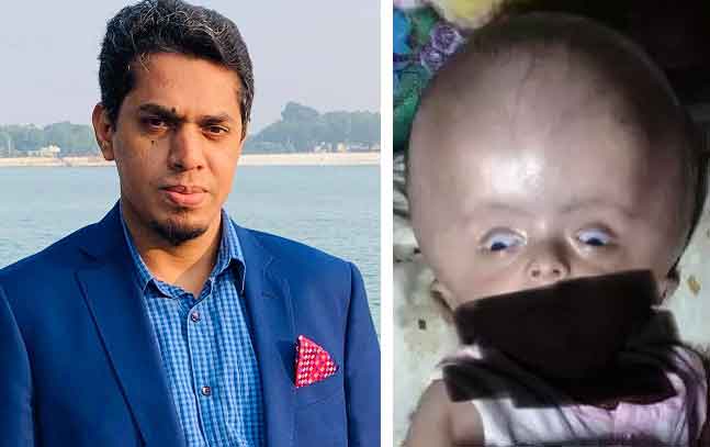 ব্রেইনে পানি জমার অত্যাধুনিক চিকিৎসা এখন বাংলাদেশেই