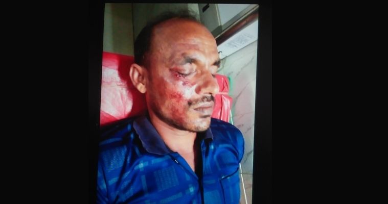 পরাজিত মেম্বারের নেতৃত্বে হামলা, মোংলায় ৪ জন আহত