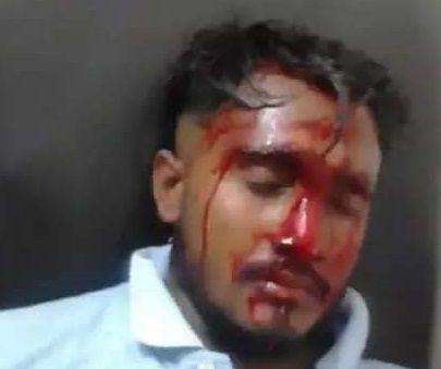 গজারিয়ায়  প্রতিপক্ষের হামলায় যুবক আহত