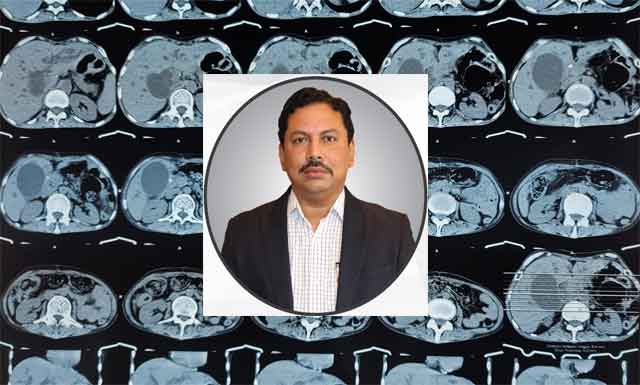 পিত্ত নালীতে টিউমার হয়েও জন্ডিস হতে পারে