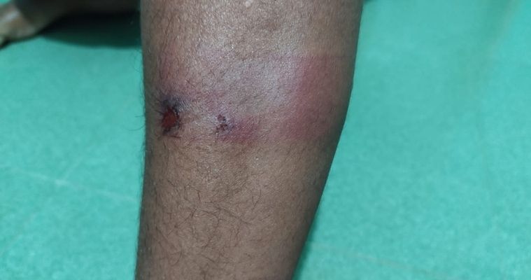 পরীক্ষায় না দেখানোয় সহপাঠীকে মারধরের অভিযোগ