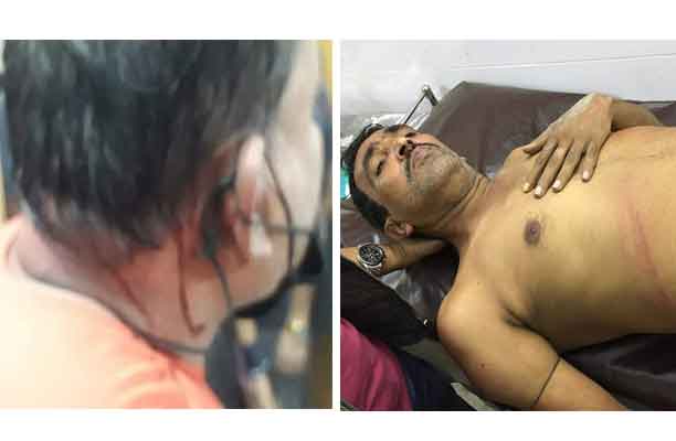 দুই আ’লীগ নেতার মাথা ফাটালো কাদের মির্জার অনুসারীরা