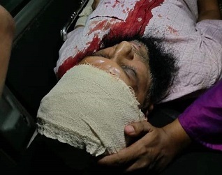 গজারিয়ায় ব্যবসায়ীকে কুপিয়ে ৭ লক্ষ টাকা ছিনতাই, একাধিক ব্যক্তি আটক