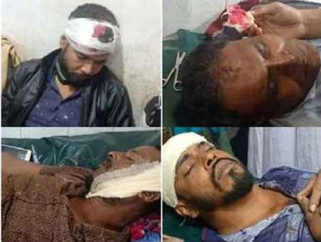 দুই ইউপি সদস্য প্রার্থীর সমর্থকদের সংঘর্ষে আহত ১২