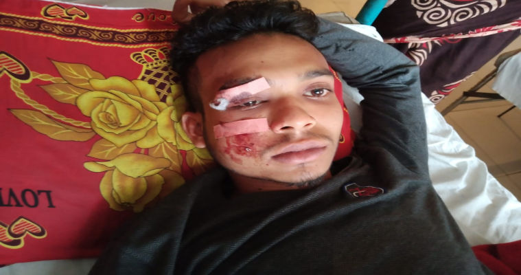 মোল্লাহাটে যুবককে কুপিয়ে ছিনতাইয়ের অভিযোগ