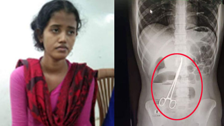 দেড় বছর পর পেট থেকে বের হলো সেই কাঁচি!