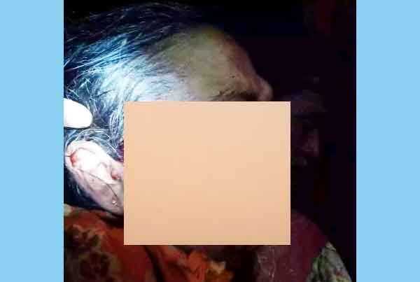 মোড়েলগঞ্জে জমির বিরোধে মা ও ছেলেকে কুপিয়ে জখম