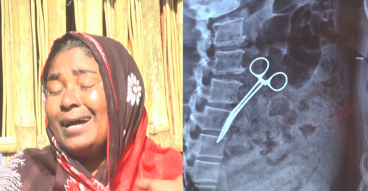 ২০ বছর ধরে পেটে কাঁচি থাকার ঘটনায় তদন্ত কমিটি