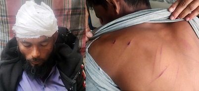 মোড়েলগঞ্জে খড় কাটা নিয়ে সংঘর্ষে আহত ৫