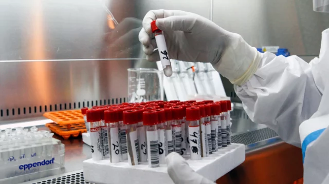 করোনায় শনাক্ত বেড়েছে