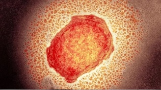 মাঙ্কিপক্স ছড়াতে পারে ২১৯টি দেশে