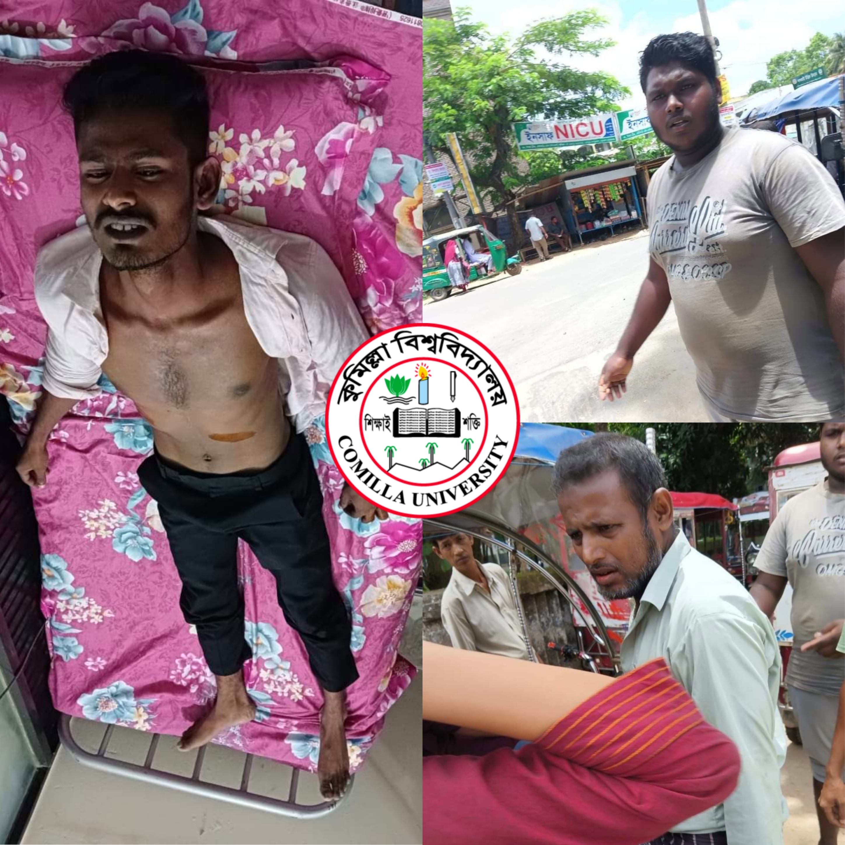 অটো ড্রাইভারের ধারালো অস্ত্রের আঘাতে আহত কুবি শিক্ষার্থী