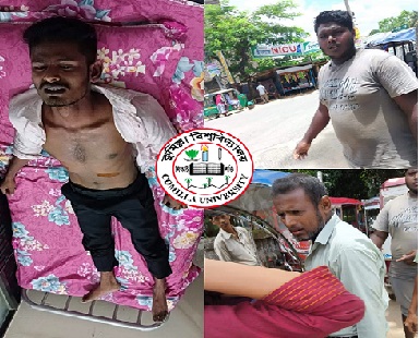 অটো ড্রাইভারের ধারালো অস্ত্রের আঘাতে আহত কুবি শিক্ষার্থী