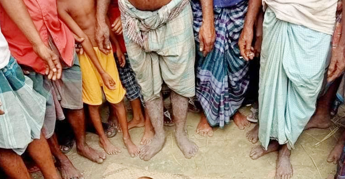 বিদ্যুতের তার ছিঁড়ে প্রাণ গেল একই পরিবারের ৩ জনের