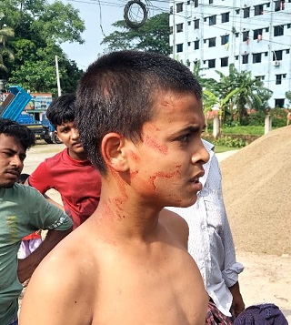 নোয়াখালীতে বিএনপির প্রতিবাদ সভার মঞ্চে ছাত্রলীগ,যুবলীগের হামলা,আহত ৩০