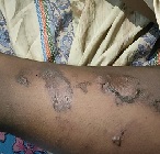 গরম পানিতে শিশুকে ঝলসে দেওয়ায় তরুণী গ্রেফতার