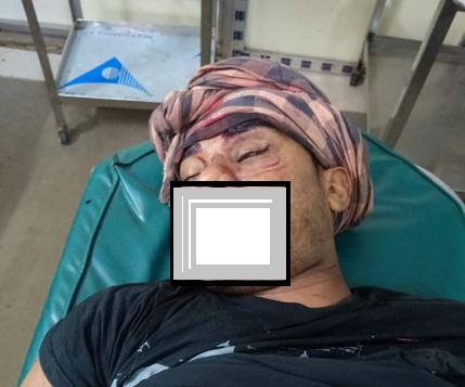 নোয়াখালীতে মাইক্রোবাস-মোটরসাইকেল সংঘর্ষে প্রবাসীর মৃত্যু