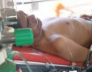 বালু তোলাকে কেন্দ্র করে মেয়রসহ গুলিবিদ্ধ ৩