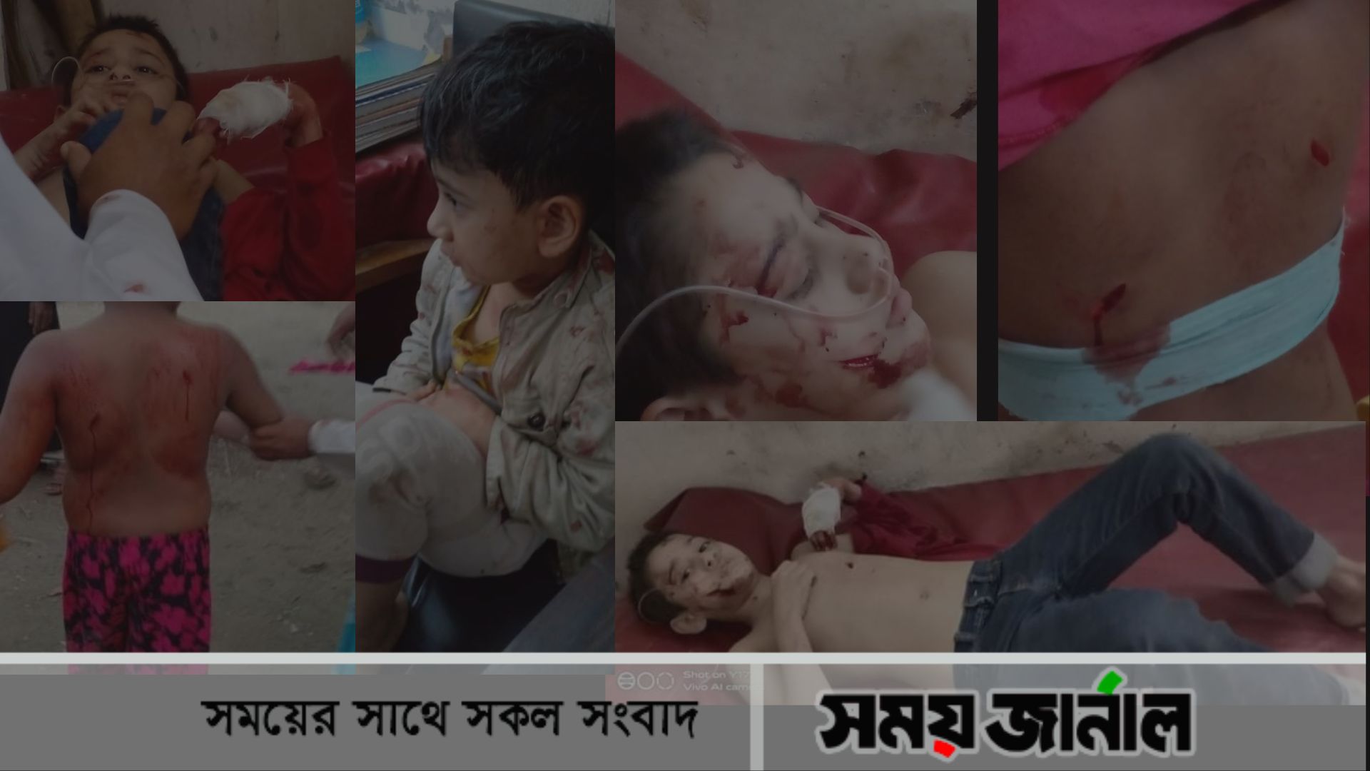 সম্পত্তি নিয়ে বিরোধ: ৫ শিশুকে কুপিয়ে হত্যার চেষ্টা করল সাবেক নারী ইউপি সদস্য