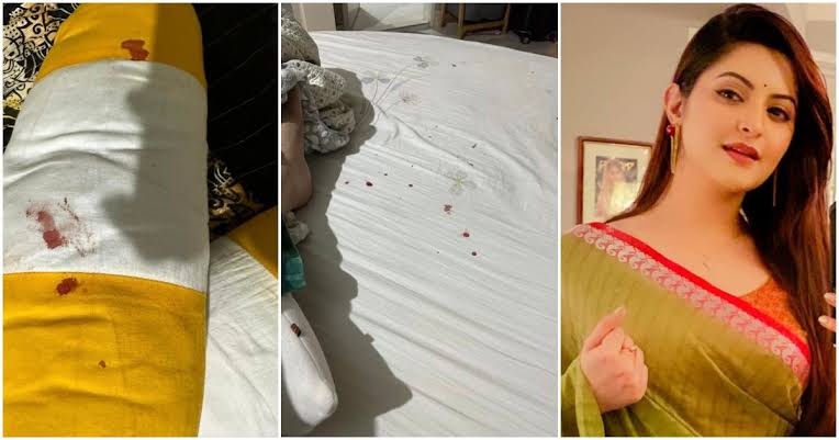 রক্তমাখা ছবি দেখিয়ে পরীমনি বললেন, সংবাদ সম্মেলন করবেন