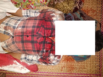 কবিরহাটে গাছ চাপা পড়ে এসএসসি পরীক্ষার্থীর মৃত্যু