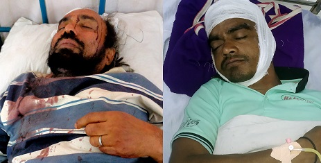 মোরেলগঞ্জে বসতবাড়ির রাস্তা  নিয়ে দু'পক্ষের হামলায় আহত ২