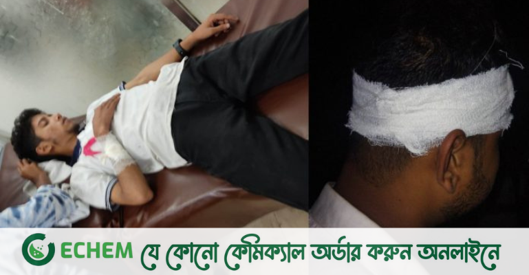 ঘুরতে যেয়ে হামলার শিকার তিতুমীর কলেজের শিক্ষার্থীরা