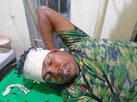 বকেয়া টাকা চাওয়ায় প্রতিপক্ষের কাঁচির আঘাতে সাংবাদিক রক্তাক্ত