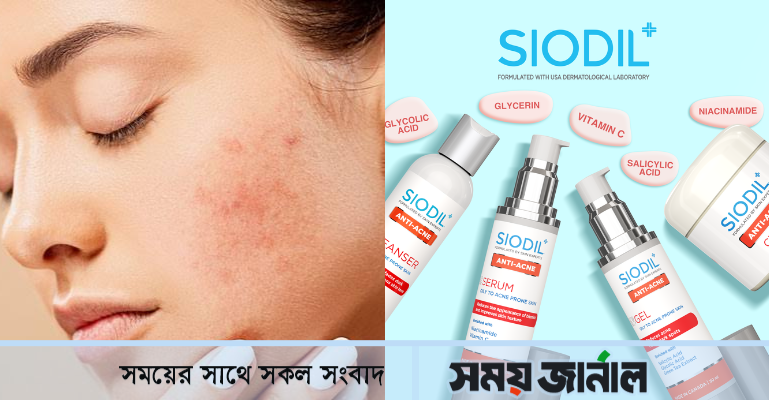 ব্রণ সমস্যা: মেনে চলুন কিছু টিপস