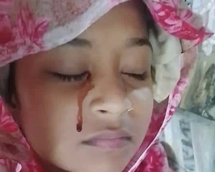 খুলনার কয়রায় বিরল রোগে আক্রান্ত মোহনা বাঁচতে চায়