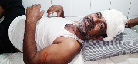 ফরিদপুরে ইউএনও’র উপর হামলা, ইউএনও সহ ৭ জন আহত