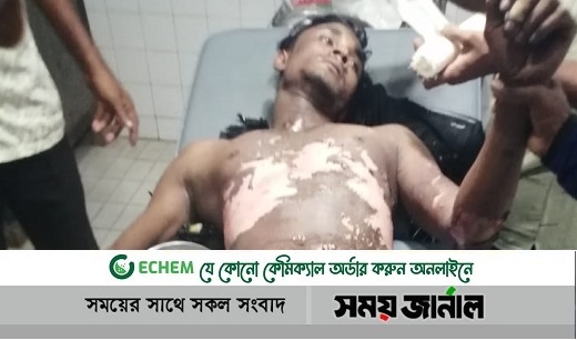 বিদ্যুতের খুঁটিতে চলছে কাজ, চলে এল বিদ্যুৎ: দগ্ধ লাইনম্যান