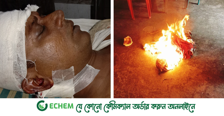 নোয়াখালীতে ফেসবুক পোস্টকে কেন্দ্র করে সংঘর্ষ,অগ্নিসংযোগ-লুটপাট