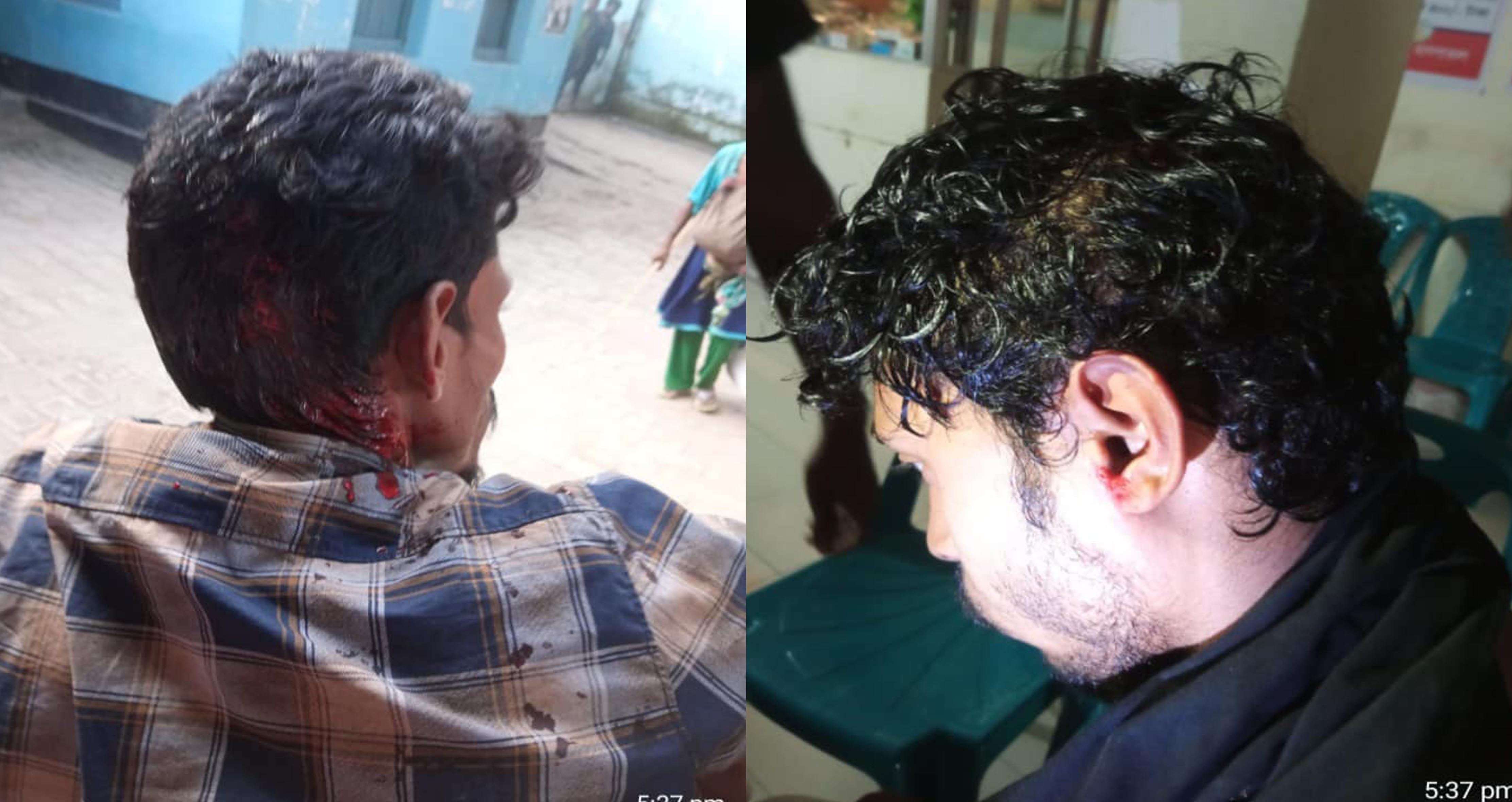 নাটোরে মেয়রের ভাতিজা ছাত্রলীগ নেতাকে পেটানোর অভিযোগ এমপি সমর্থকদের বিরুদ্ধে