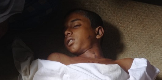 বাড়ি ফেরার পথে বজ্রপাতে মাদরাসা ছাত্রের মৃত্যু