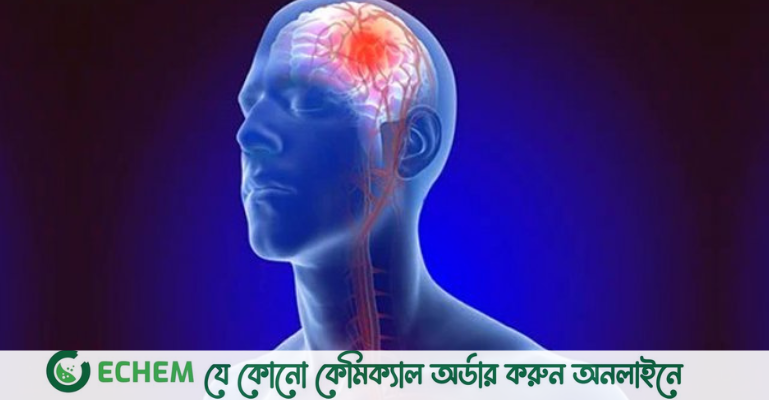 যাদের মধ্যে ব্রেইন স্ট্রোক হওয়ার ঝুঁকি বেশি