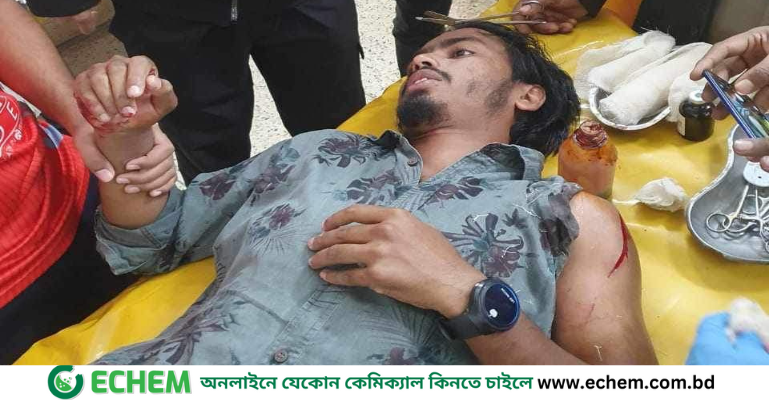 দুর্বৃত্তদের হামলায় বশেমুরবিপ্রবি শিক্ষার্থী গুরুতর আহত