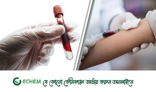 যে ৫টি রক্ত পরীক্ষা সকলেরই করা উচিত