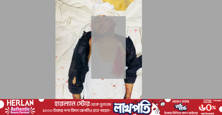 মেহেদির রং শুকানোর আগে প্রাণ গেল তরুণের