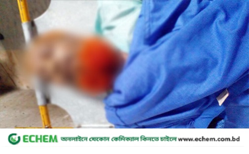 অতিরিক্ত গরমে ঢাকায় পথচারীর মৃত্যু