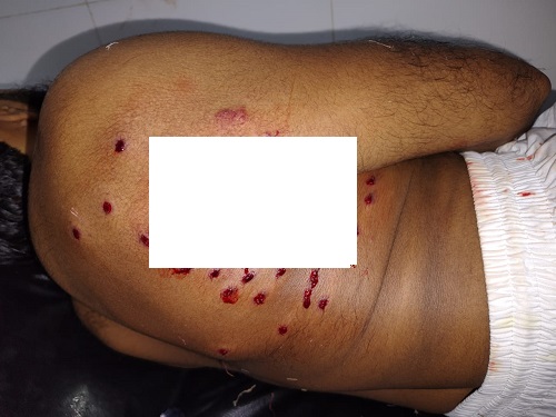 নোয়াখালীতে মোটরসাইকেল ছিনতাই করতে মাদরাসা শিক্ষককে গুলি