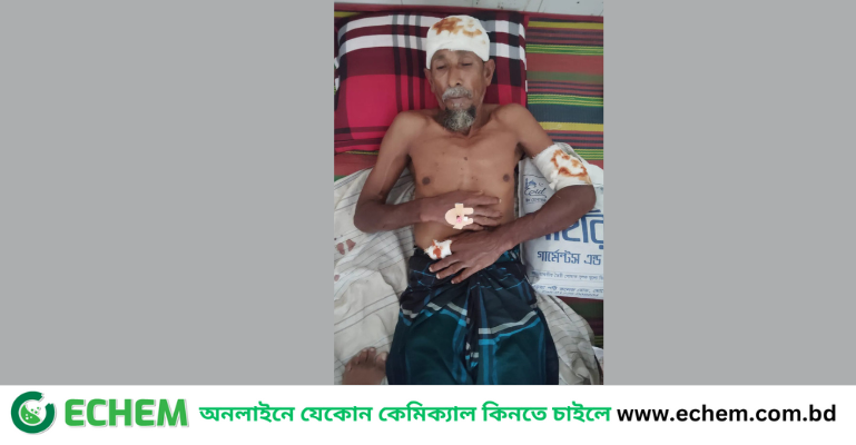 বাগেরহাটে  দুই ভাইকে কুপিয়ে জখম