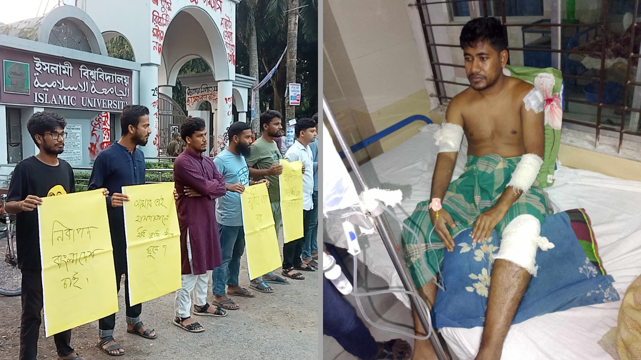ঝিনাইদহে ইবি শিক্ষার্থীকে কুপিয়ে জখম, বিচারের দাবিতে মানববন্ধন