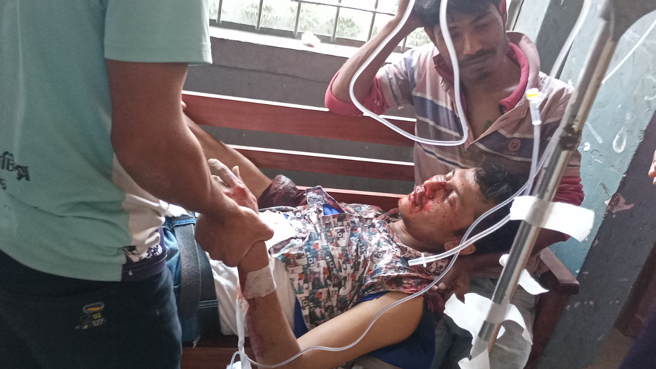 কিশোরগঞ্জে পৃথক পৃথক দুর্ঘটনায় নিহত-১,আহত ৪